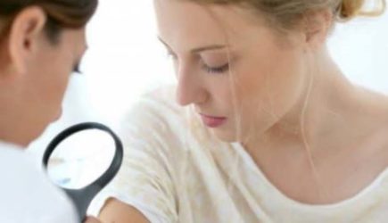 Красные родинки: из-за чего они появляются